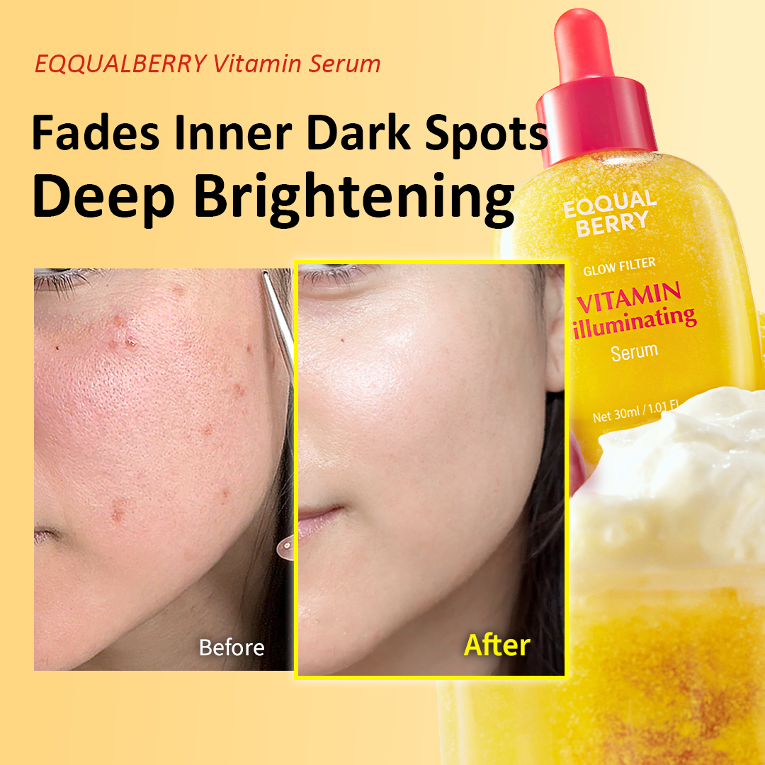[Amazon No.1 ] Vitamin Illuminating Dark Spot Serum