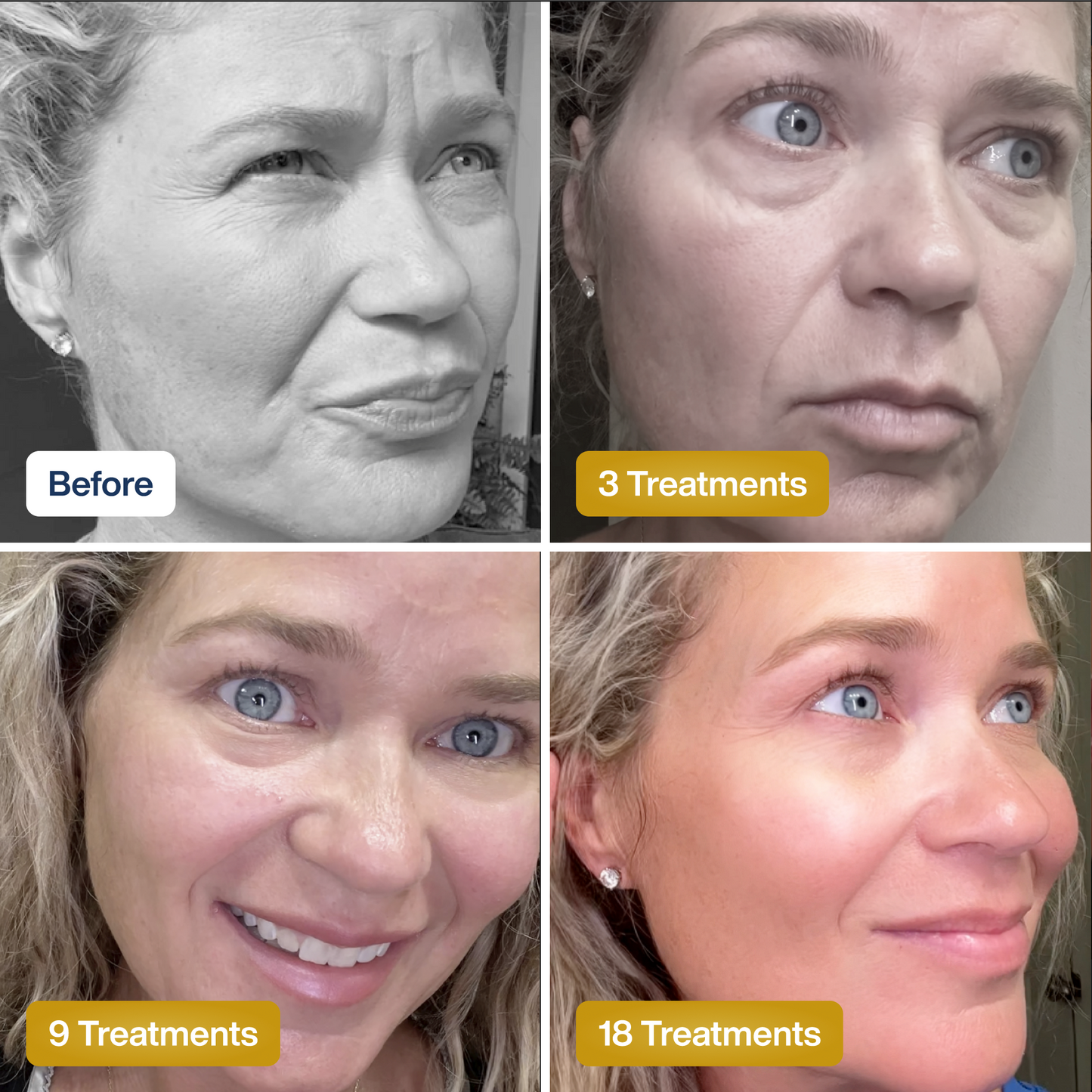 Lume Beauty© Collagen Facial Mask