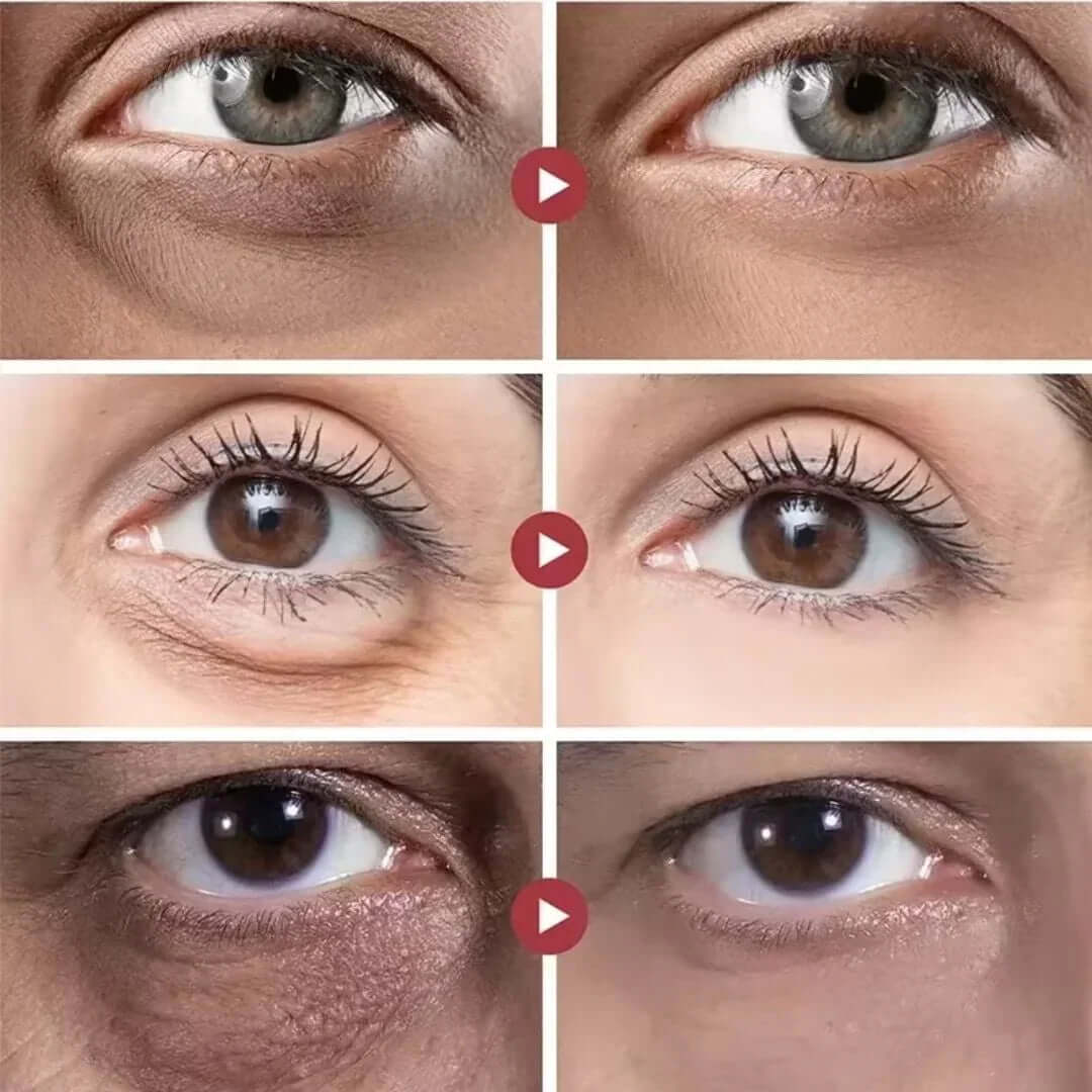 “The Korean trick that reduces deep dark circles in up to 7 days without spending on clinics” - Lutein Glow®