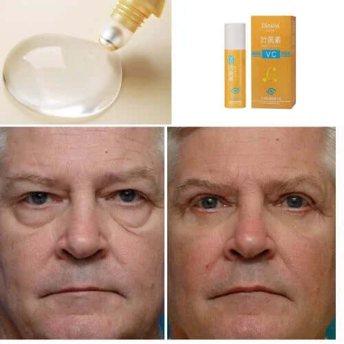 “The Korean trick that reduces deep dark circles in up to 7 days without spending on clinics” - Lutein Glow®